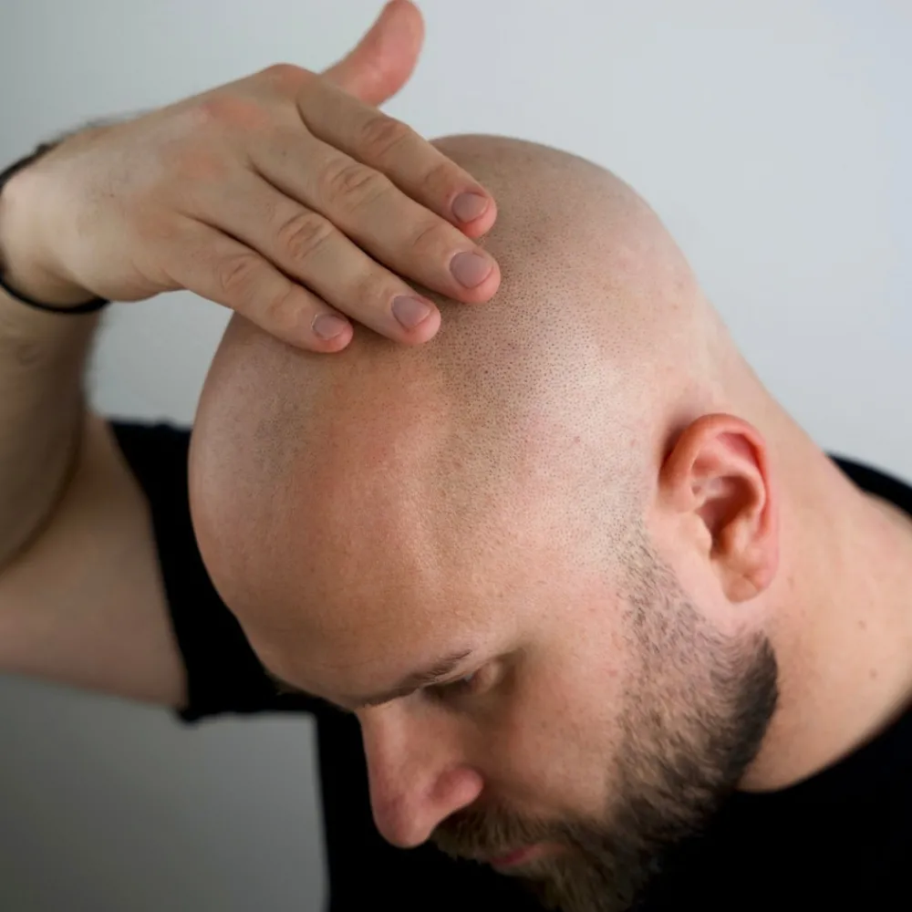 BetterBeBold Kaljun Hoito>Magic Bald Head & Beard Oil 30ml
