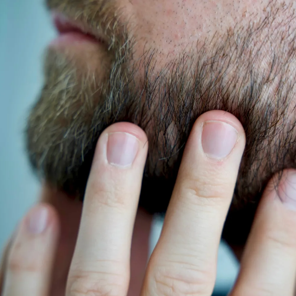 BetterBeBold Kaljun Hoito>Magic Bald Head & Beard Oil 30ml
